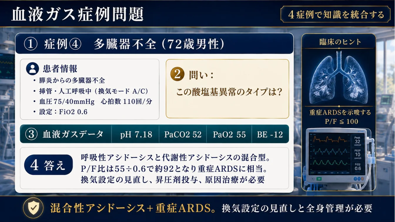 症例④ 多臓器不全